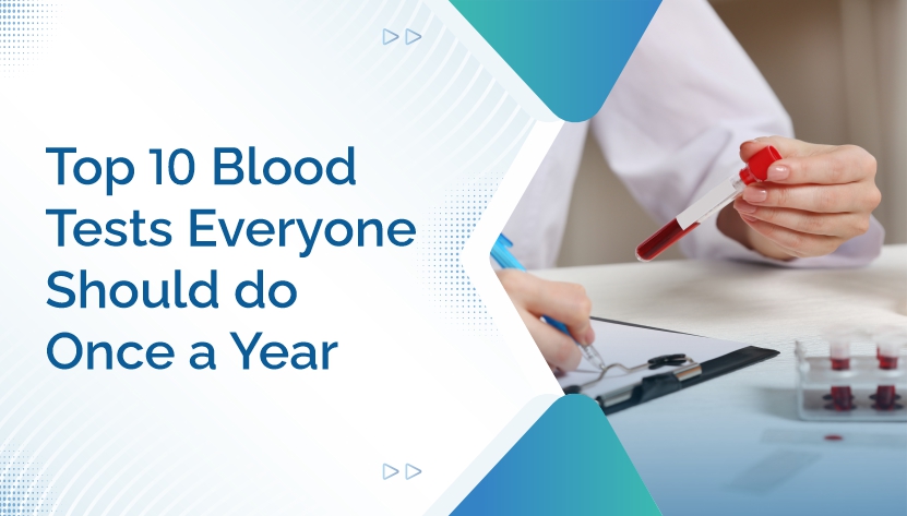 Top 10 Blood Tests Everyone Should Do Once a Year